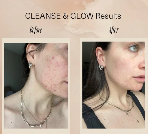 Cleanse & Glow Set by Aloisia Beauty-1