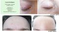 MERVEILLE DES LANDES ORGANIC - Sensitive Skin Care Complete Regeneration Face-10