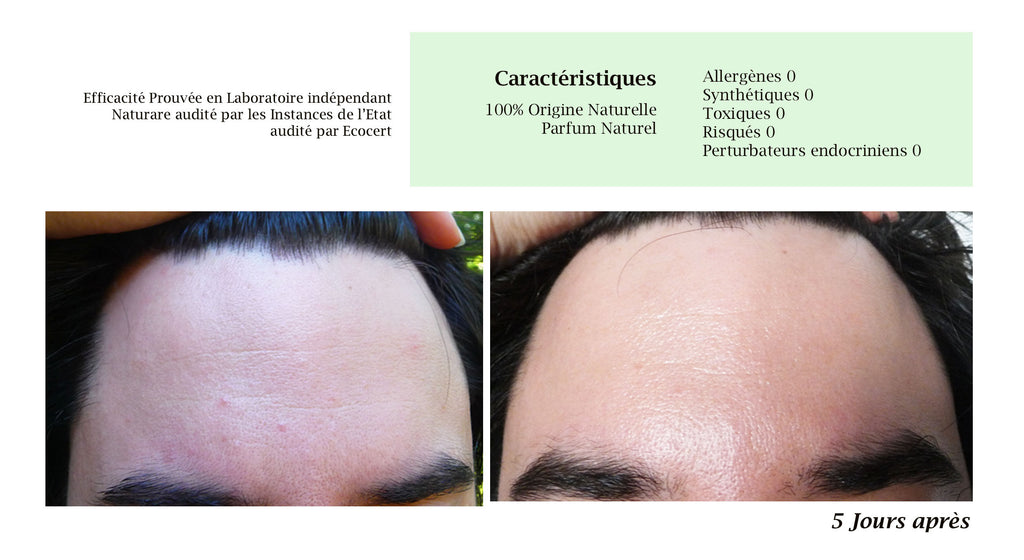 MERVEILLE DES LANDES ORGANIC - Sensitive Skin Care Complete Regeneration Face-12